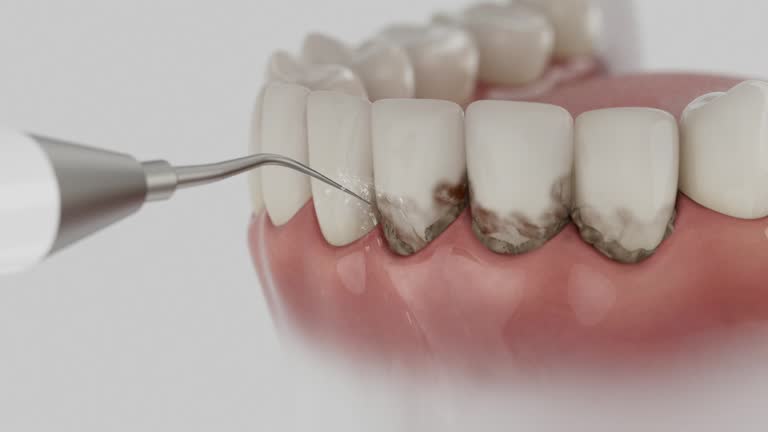 Reliable Dental contractor in Arlington, VA by Smile Center Dentistry